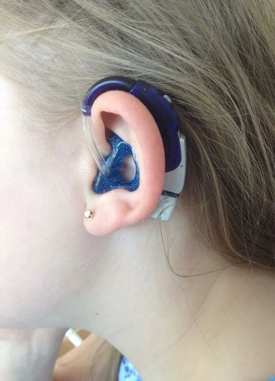 Aparelho Auditivo em Luiz Antônio/SP