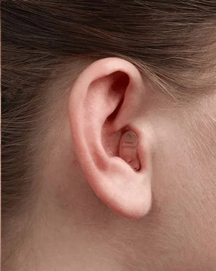 Aparelho-auditivo-em-Serrana-SP